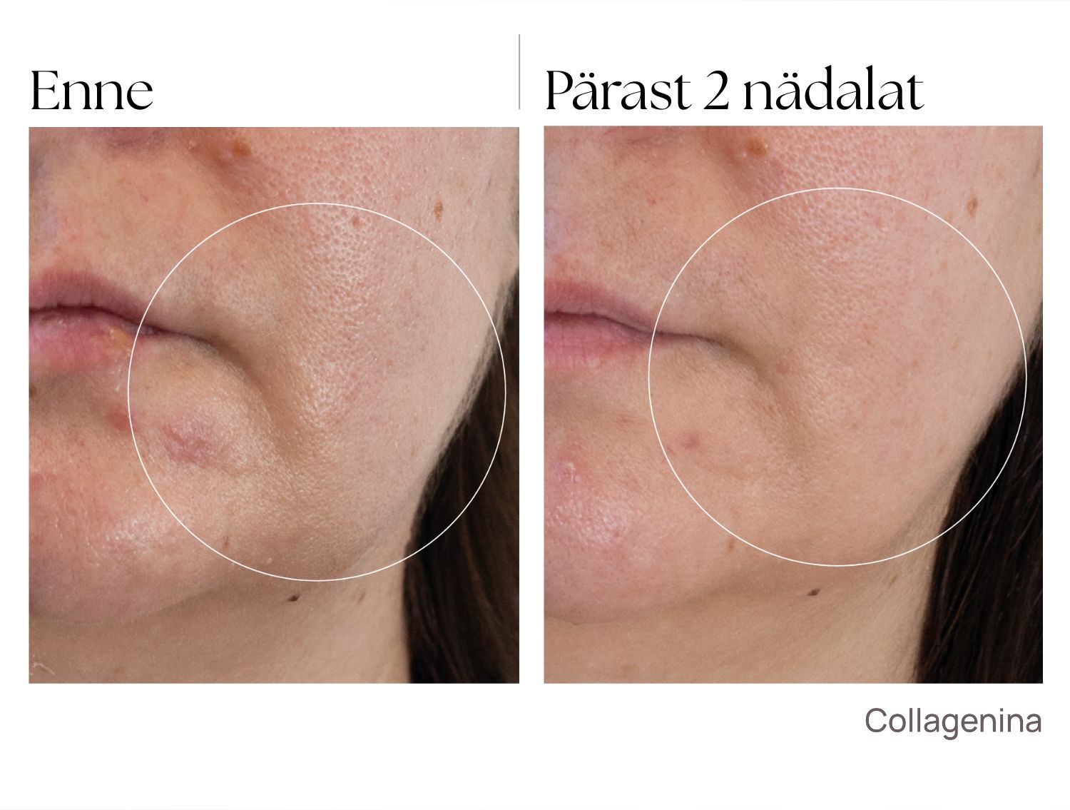 collagenina_tulemused_intensiivhooldus